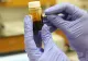 Alertă sanitară globală: o ciupercă letală care devorează corpul se răspândește accelerat pe fondul încălzirii globale