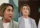 Premieră medicală în Spania: transplant total de față de la o pacientă care a ales eutanasierea