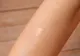Cum scapi de cicatrici. Remediul natural care le șterge ca prin magie 