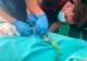 Misiune dificilă în Mureş. Pompierii au eliberat mâna unui copil de doi ani prinsă într-o maşină de tocat