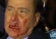Bărbatul care l-a lovit pe Berlusconi şi-a cerut scuze 