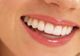 Adio dinți galbeni! Cum să îți păstrezi zâmbetul strălucitor