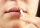 Cum să ții herpesul sub control cu remedii naturale