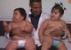 BEBELUŞII care au ŞOCAT medicii: cântăresc peste 20 de kg, la doar 10 luni