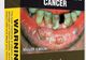 Ce sunt ţigările "neutre" pe care vor sa le introducă francezii în lupta contra fumatului