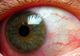 Ochiul roşu poate trăda probleme grave de sănătate. 4 situaţii în care trebuie să te îngrijorezi