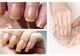 Ai unghiile galbene? Uite cum să le albeşti rapid!