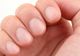 De ce îți crește unghia degetului mijlociu mai repede decât celelalte