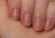 Cea mai simplă soluţie pentru unghiile îngălbenite. Scapă de această problemă cu un produs banal