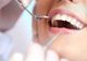Studiu: Jumătate dintre românii care ajung la dentist au nevoie de tratamente complexe 