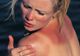 10 remedii naturale pentru calmarea arsurilor solare. Scapi imediat de usturime şi durere!