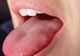 Testul care iţi verifică starea de sănătate. Dacă ai aşa ceva pe limbă, fugi imediat la medic!