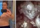 A acceptat să fie mamă surogat la doar 21 de ani. La prima ecografie, doctorii au rămas fără cuvinte