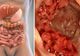 Ai aceste simptome? Mergi de URGENŢĂ la medic! E cancer de colon