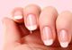Remedii incredibil de simple și ieftine pentru micoza unghiilor