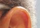 Dacă urechea ta arată așa, ai putea fi în pericol de accident vascular cerebral