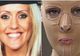 I-a dat foc acestei blonde din cauză că era prea frumoasă. Cum arată fata după reconstrucţia pielii
