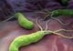Bacteria care îți poate afecta stomacul pe termen lung