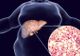 Steatoza hepatică: Cauze și simptome
