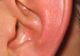 ÎNFIORĂTOR ce a descoperit un medic în urechea unui bărbat! Nu te uita dacă ai probleme cu inima 