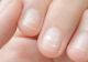 Nu este lipsă de calciu! Ce semnifică, de fapt, petele albe de pe unghii