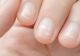 Ce sunt, de fapt, petele albe de pe unghii și de ce apar? Contrar legendei, nu arată deficiență de calciu