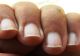 Bolile pot fi citite pe unghii.  Cum poți recunoaște afecțiunile de care suferi, analizându-ți unghiile