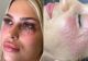 Procedura cosmetică controversată: Cum mesoterapia poate duce la efecte neașteptate. Zeci de tinere au ajuns să aibă piele de reptilă