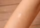 Cum scapi de cicatrici. Remediul natural care le șterge ca prin magie 