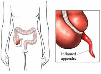 Foto: genciencia.com